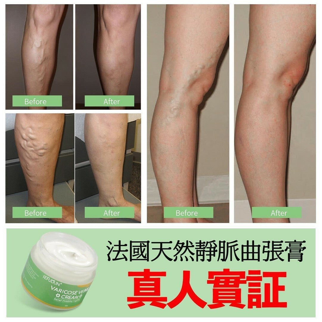 法國SEFUDUN天然靜脈曲張膏50g