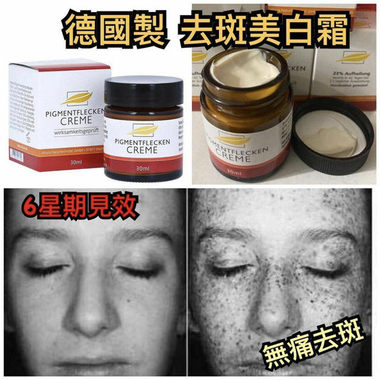 【一口價$130/盒】德國Pigmentflecken Creme去斑美白霜 30ml