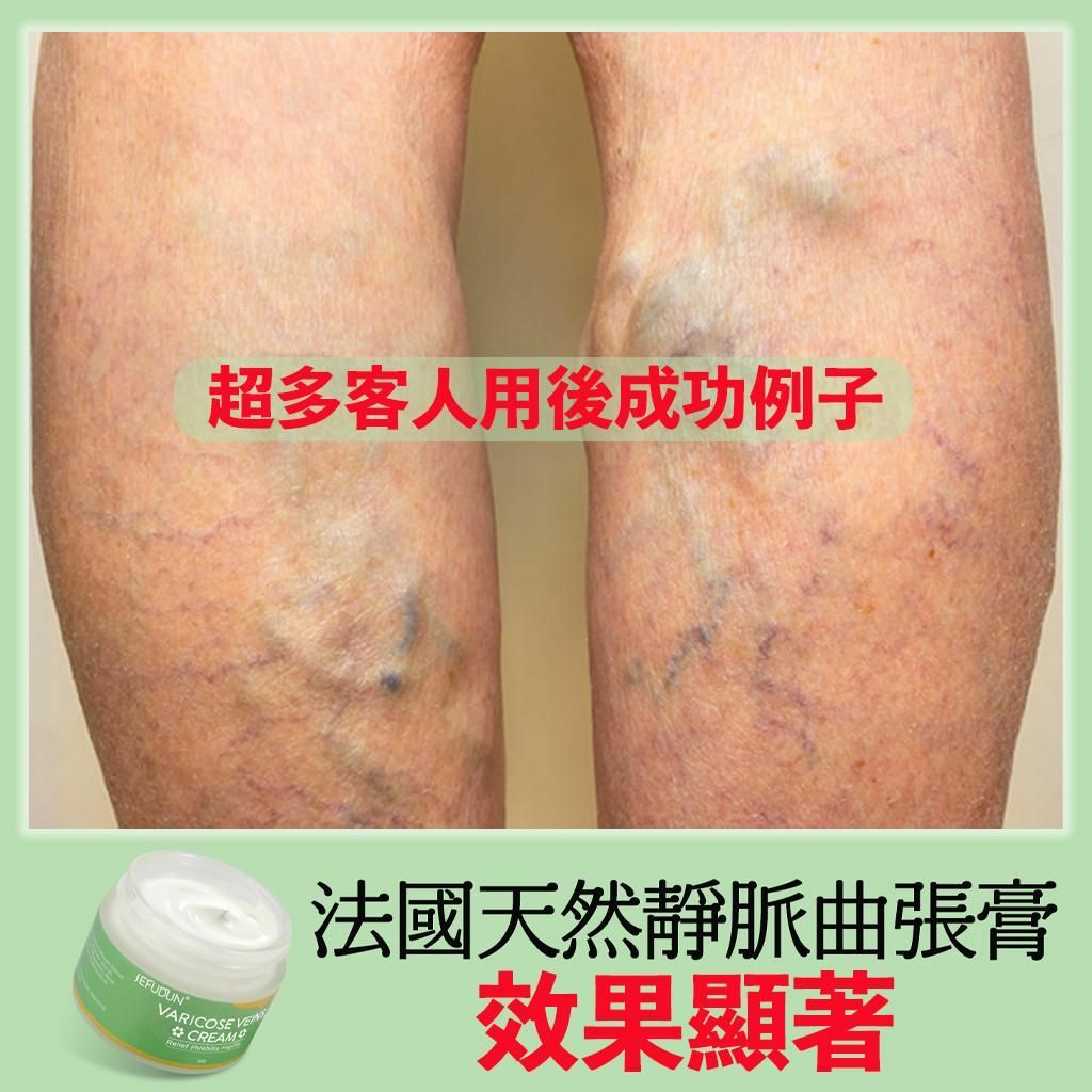 法國SEFUDUN天然靜脈曲張膏50g