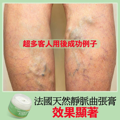 法國SEFUDUN天然靜脈曲張膏50g
