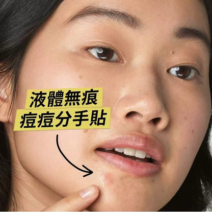 Kiehl's 水楊酸抗粉刺精華液體貼 15ml